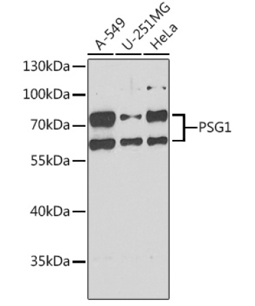 PSG1 Rabbit Polyclonal Antibody