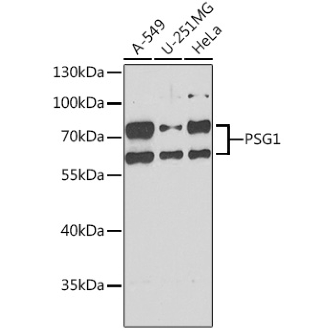 PSG1 Rabbit Polyclonal Antibody