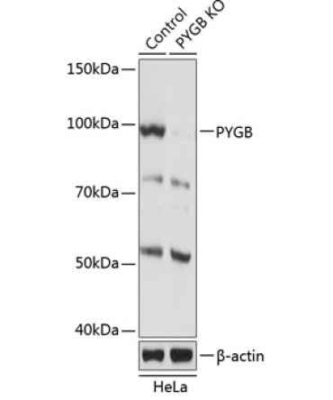 PYGB Rabbit Polyclonal Antibody