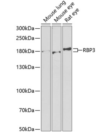 RBP3 Rabbit Polyclonal Antibody