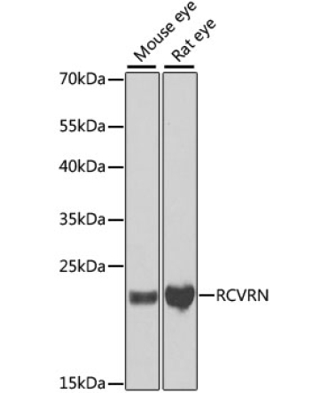 RCVRN Rabbit Polyclonal Antibody