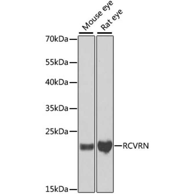 RCVRN Rabbit Polyclonal Antibody