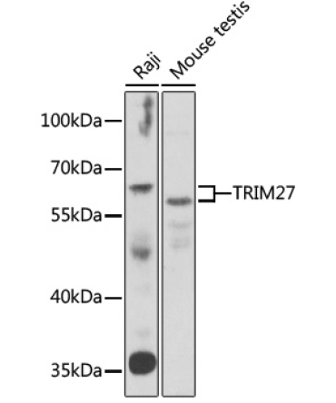 TRIM27 Rabbit Polyclonal Antibody