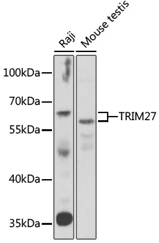 TRIM27 Rabbit Polyclonal Antibody