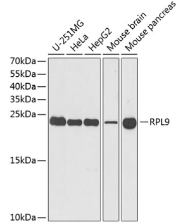 RPL9 Rabbit Polyclonal Antibody