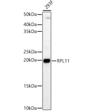 RPL11 Rabbit Polyclonal Antibody