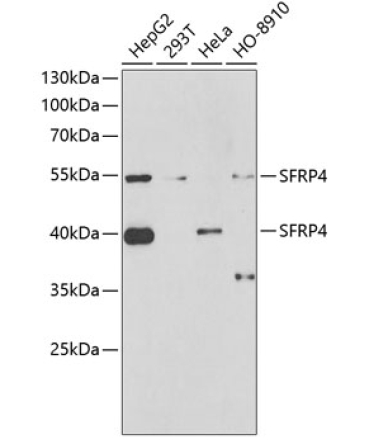 SFRP4 Rabbit Polyclonal Antibody