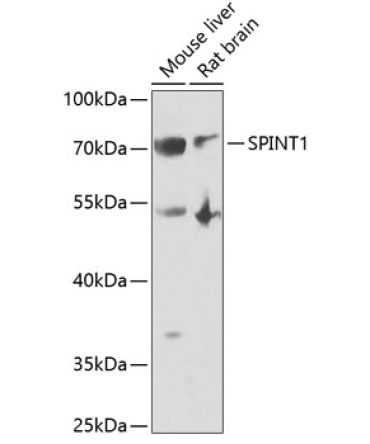SPINT1 Rabbit Polyclonal Antibody