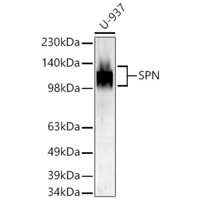 SPN Rabbit Polyclonal Antibody