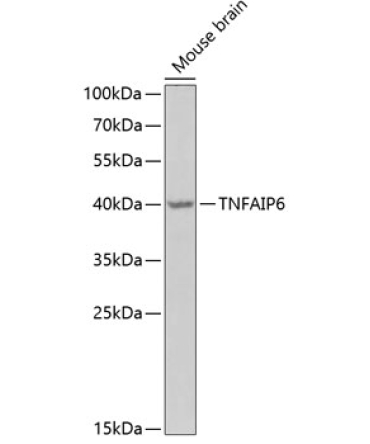TNFAIP6 Rabbit Polyclonal Antibody