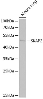 SKAP2 Rabbit Polyclonal Antibody