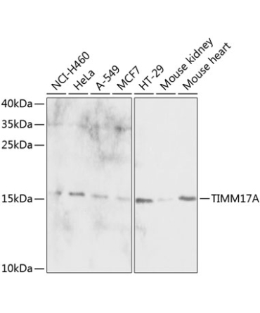 TIMM17A Rabbit Polyclonal Antibody