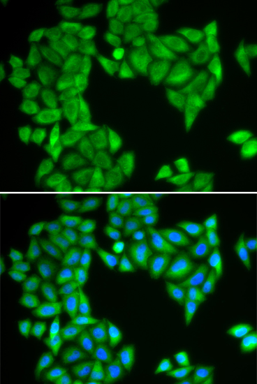 SPAG5 Rabbit Polyclonal Antibody