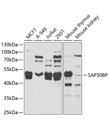 SAP30BP Rabbit Polyclonal Antibody