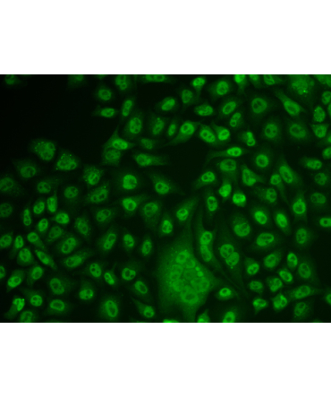 TFPT Rabbit Polyclonal Antibody