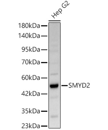 SMYD2 Rabbit Polyclonal Antibody