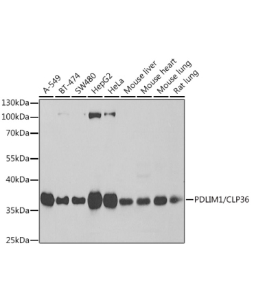 PDLIM1/CLP36 Rabbit Polyclonal Antibody