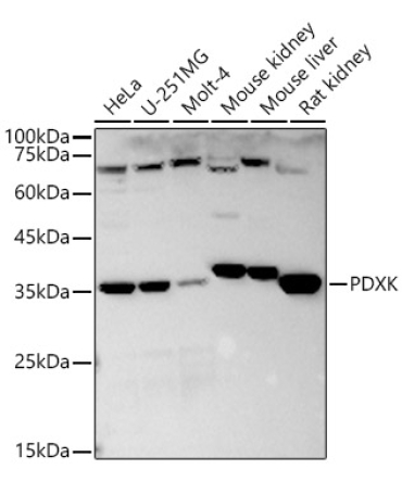 PDXK Rabbit Polyclonal Antibody