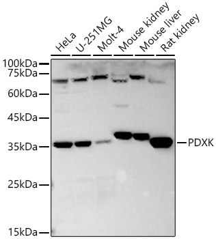 PDXK Rabbit Polyclonal Antibody