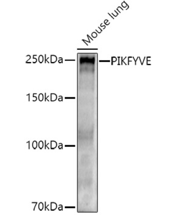 PIKFYVE Rabbit Polyclonal Antibody