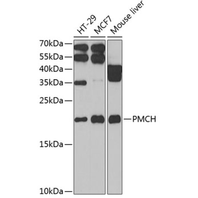 PMCH Rabbit Polyclonal Antibody