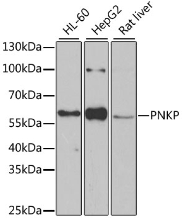 PNKP Rabbit Polyclonal Antibody