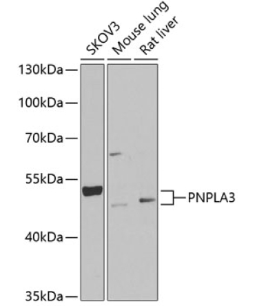 PNPLA3 Rabbit Polyclonal Antibody