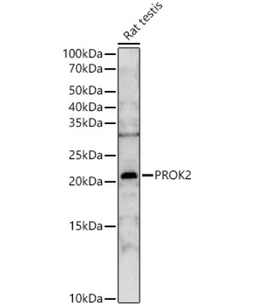 PROK2 Rabbit Polyclonal Antibody