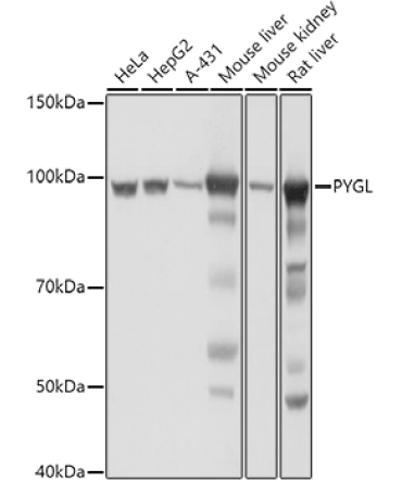 PYGL Rabbit Polyclonal Antibody