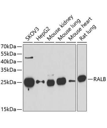 RALB Rabbit Polyclonal Antibody
