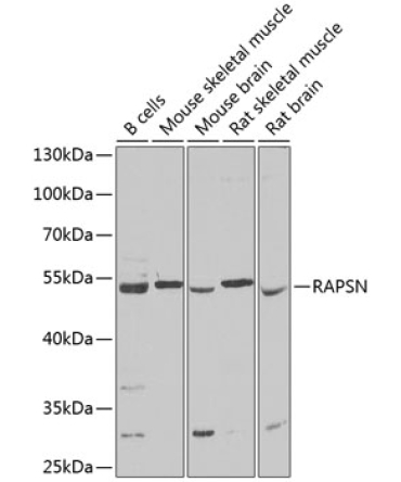 RAPSN Rabbit Polyclonal Antibody