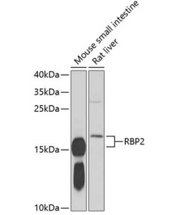RBP2 Rabbit Polyclonal Antibody