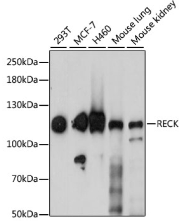 RECK Rabbit Polyclonal Antibody