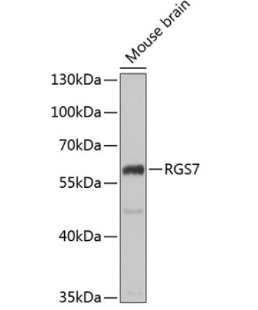 RGS7 Rabbit Polyclonal Antibody