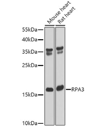 RPA3 Rabbit Polyclonal Antibody