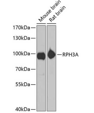 RPH3A Rabbit Polyclonal Antibody