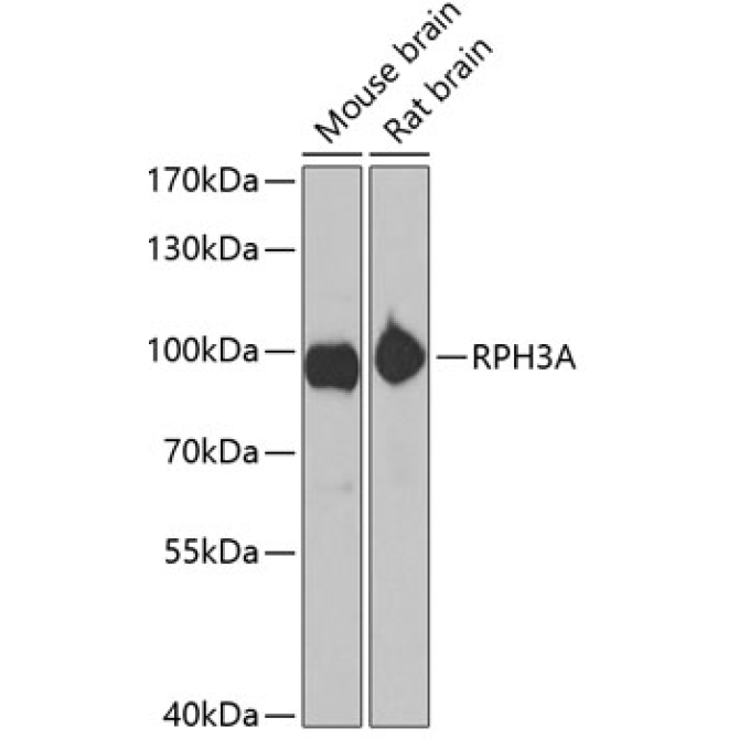 RPH3A Rabbit Polyclonal Antibody