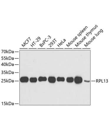 RPL13 Rabbit Polyclonal Antibody