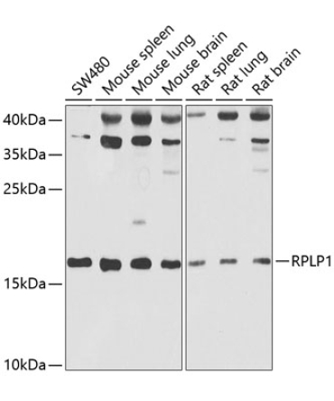 RPLP1 Rabbit Polyclonal Antibody