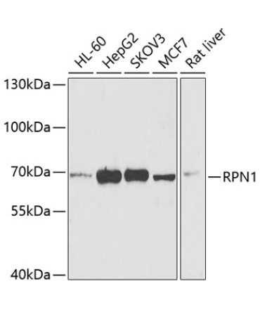RPN1 Rabbit Polyclonal Antibody