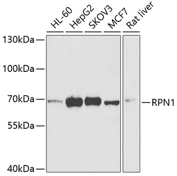 RPN1 Rabbit Polyclonal Antibody