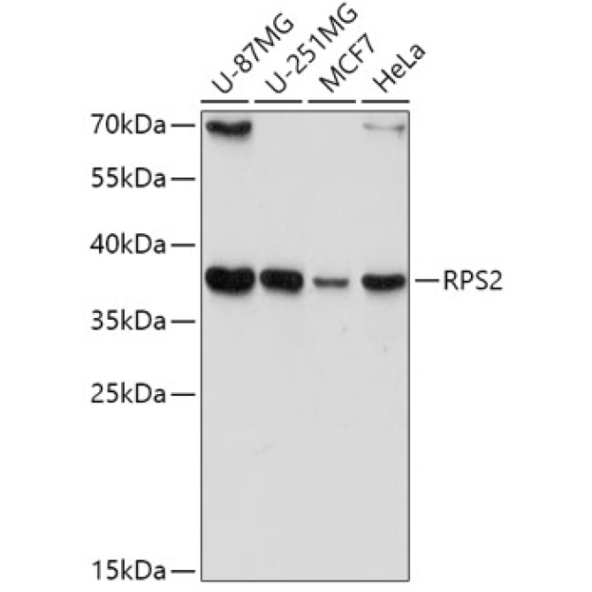 RPS2 Rabbit Polyclonal Antibody