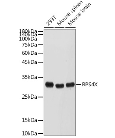 RPS4X Rabbit Polyclonal Antibody