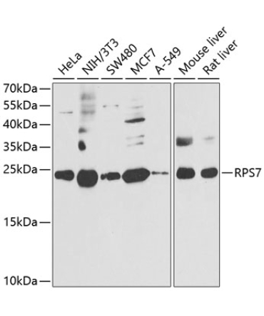 RPS7 Rabbit Polyclonal Antibody
