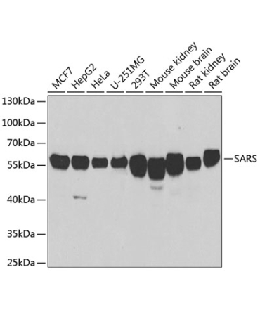 SARS Rabbit Polyclonal Antibody