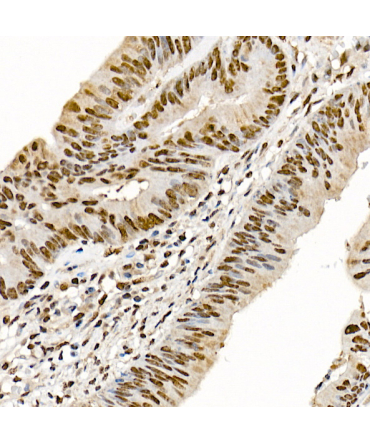 SETMAR Rabbit Polyclonal Antibody