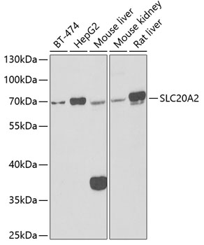 SLC20A2 Rabbit Polyclonal Antibody