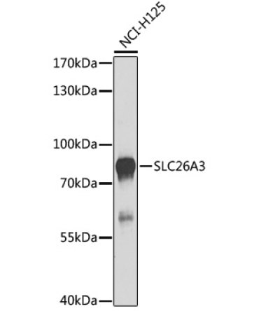 SLC26A3 Rabbit Polyclonal Antibody