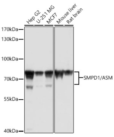 SMPD1 / ASM Rabbit Polyclonal Antibody