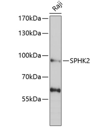 SPHK2 Rabbit Polyclonal Antibody